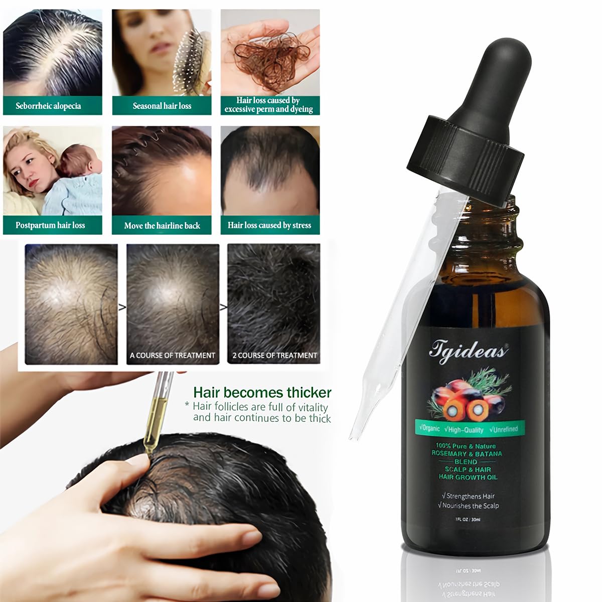 MAGIC BATANA OIL - HAIR GROWTH AND REPAIR